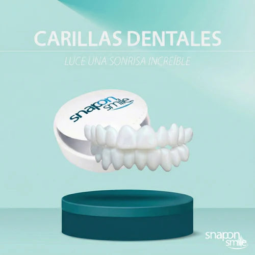 Carillas Dentales - Snap Smile: Luce una sonrisa perfecta